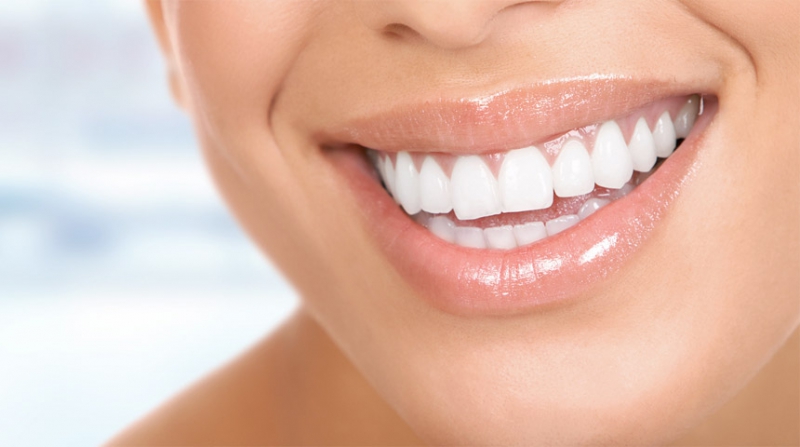 Diş Estetiği Uygulamaları Diş Estetiği Uygulamaları